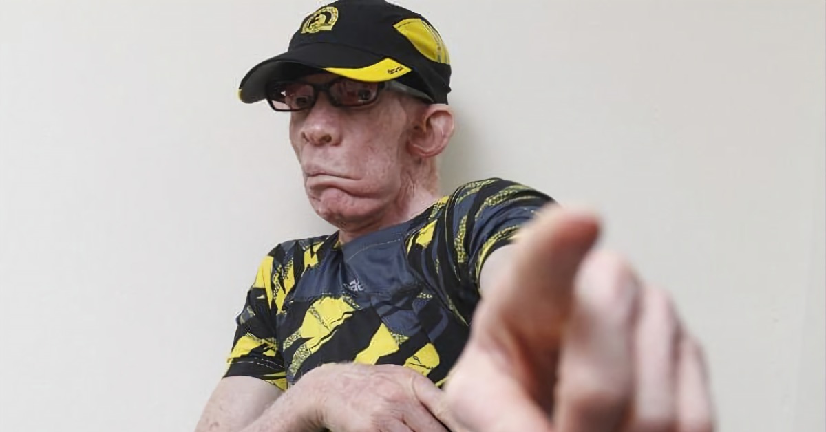 King Yellowman with Special Guest Chala, DJ Blood Preshah